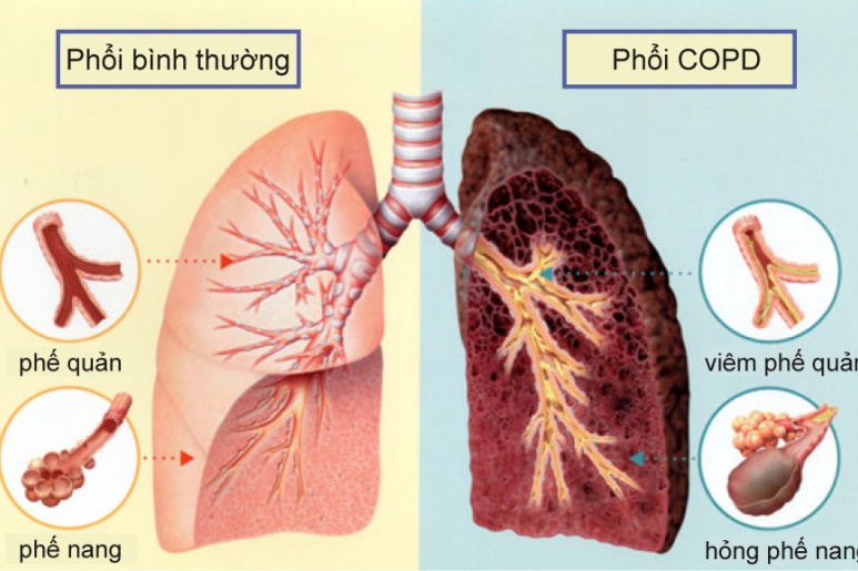 COAD - Ảnh minh họa 2