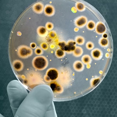 Viêm phổi cấp do vi khuẩn Legionella - Ảnh minh họa 2