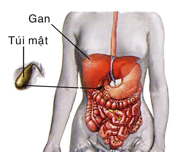 Cholecystitis - Ảnh minh họa 4