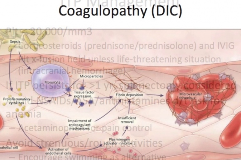 Coagulopathy - Ảnh minh họa 2