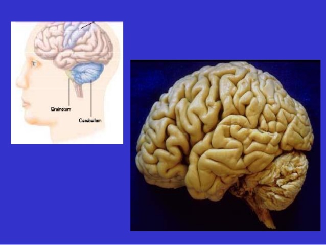 Cerebellar syndrome - Ảnh minh họa 3