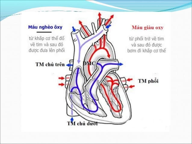 Wolff-Parkinson-White syndrome - Ảnh minh họa 3