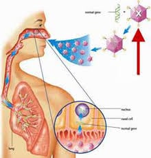 Viêm phổi cấp do vi khuẩn Legionella - Ảnh minh họa 4