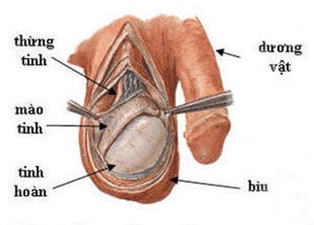 Viêm mào tinh hoàn - Ảnh minh họa 2