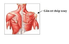 Chấn thương dây chằng vai - Ảnh minh họa 3