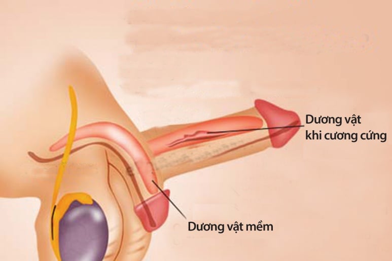 Cương đau dương vật kéo dài - Ảnh minh họa 3