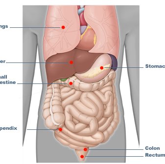 Carcinoid syndrome - Ảnh minh họa 3