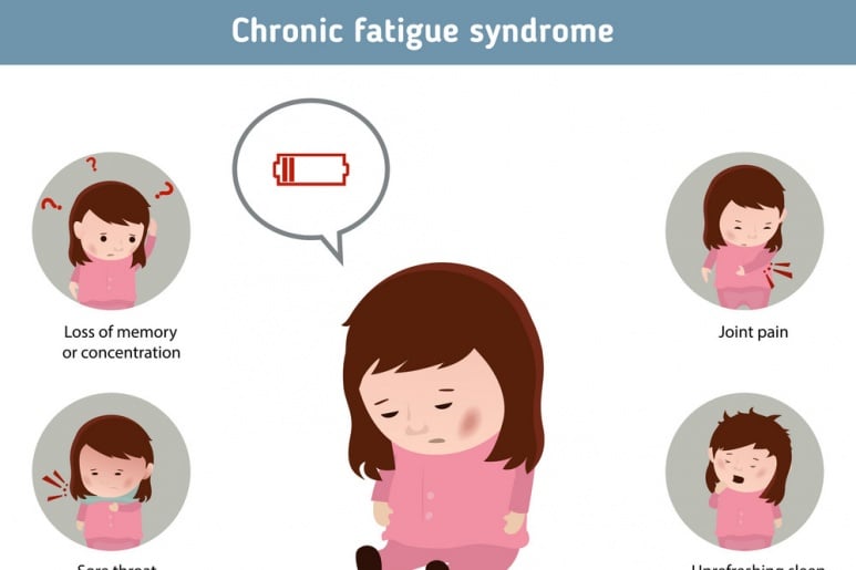 Chronic Fatigue Syndrom - Ảnh minh họa 2