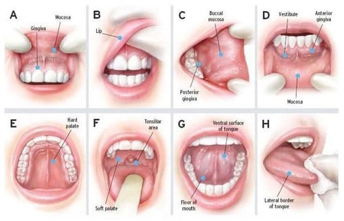 Chấn thương ở miệng - Ảnh minh họa 1