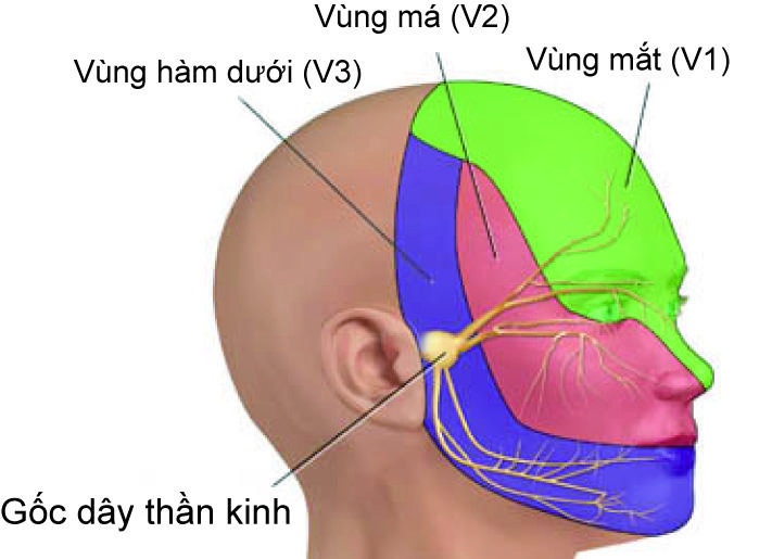 Đau dây thần kinh tam thoa - Ảnh minh họa 3