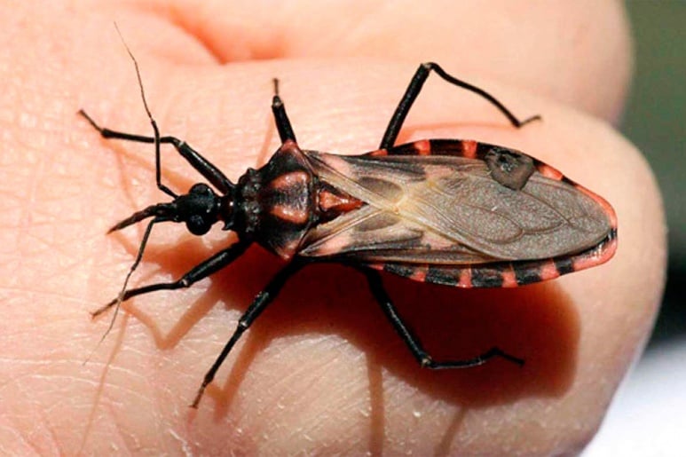 Chagas - Ảnh minh họa 3