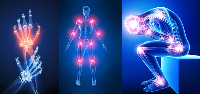 Chronic Pain - Ảnh minh họa 4