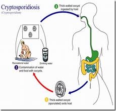 Cryptosporidium infection - Ảnh minh họa 4