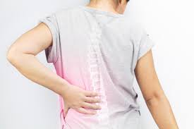 Degenerative Disc Disease - Ảnh minh họa 5