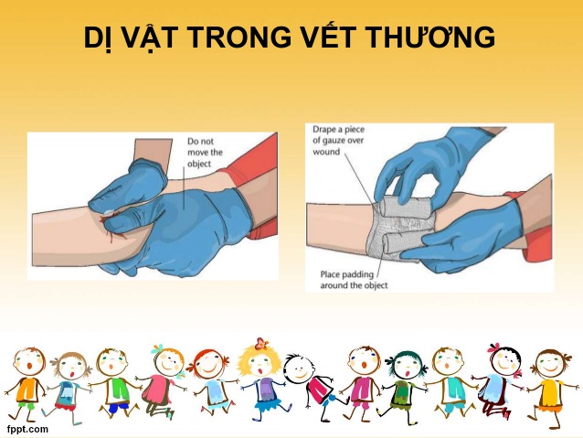 Dị vật trong vết thương - Ảnh minh họa 4