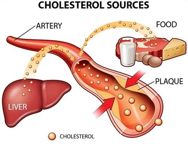 Dyslipidemia - Ảnh minh họa 1