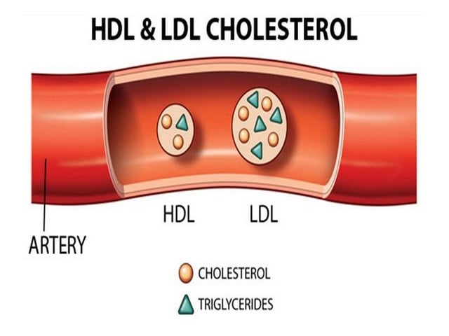 Dyslipidemia - Ảnh minh họa 2