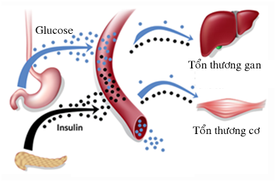 Dyslipidemia - Ảnh minh họa 4