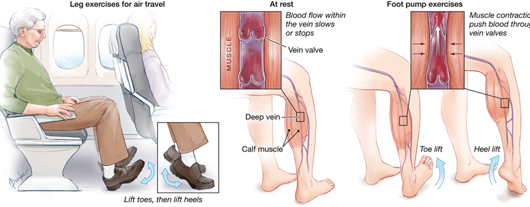 DVT - Ảnh minh họa 2