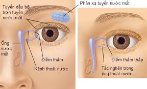 Dacryocystitis - Ảnh minh họa 2