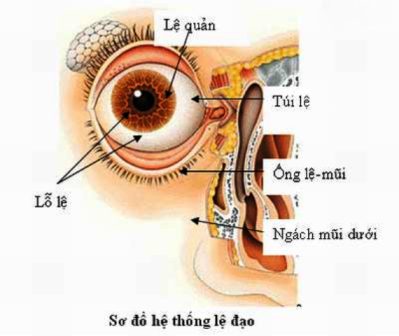 Dacryocystitis - Ảnh minh họa 3