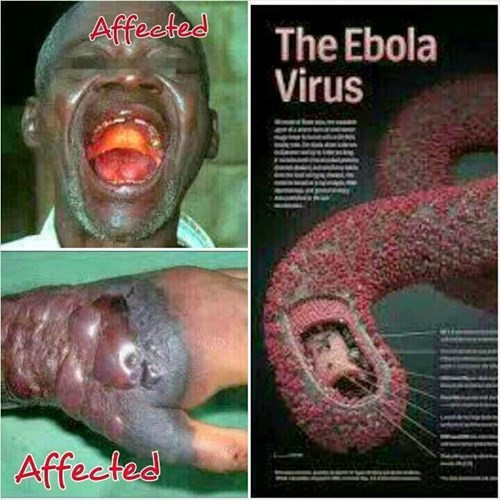 Ebola - Ảnh minh họa 1