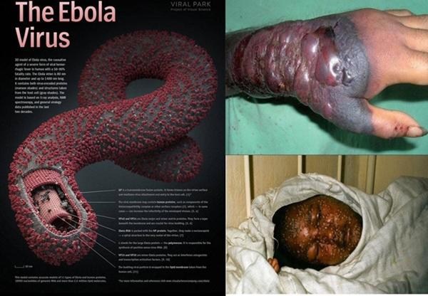 Ebola - Ảnh minh họa 3