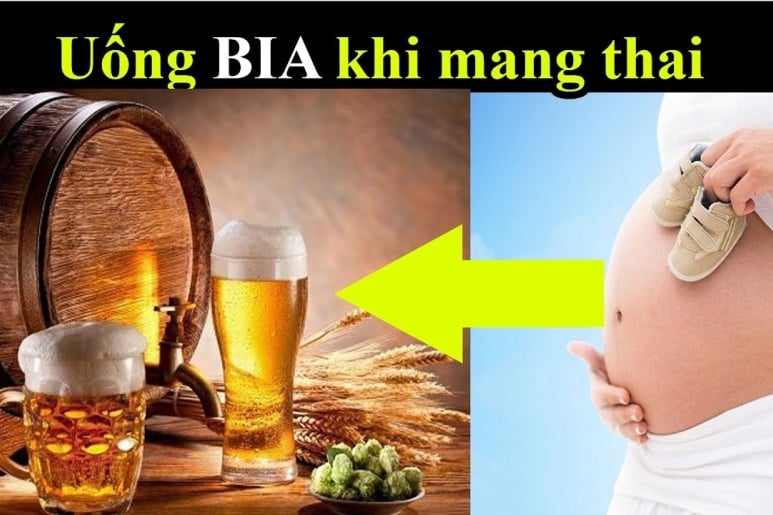 Fetal Alcohol Syndrome - Ảnh minh họa 3