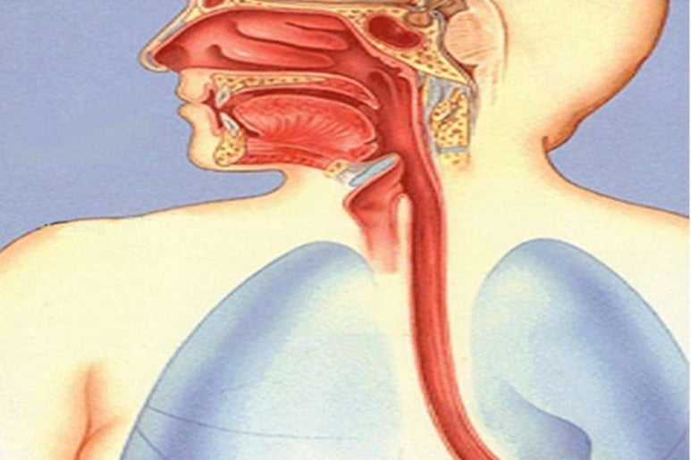 Esophageal Webs - Ảnh minh họa 1