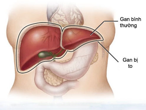 Gan to - Ảnh minh họa 2