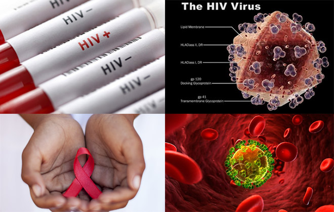 HIV/AIDS - Ảnh minh họa 4