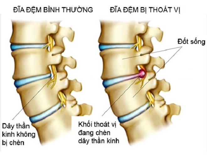 Cơ xương khớp - Ảnh minh họa 4