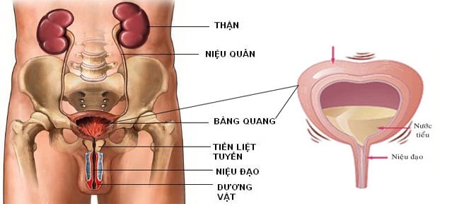 Hội chứng đau bàng quang - Ảnh minh họa 3