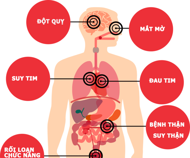 Hypertensive Emergency - Ảnh minh họa 3