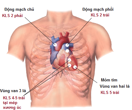 Ứng dụng của nghe tim trong chẩn đoán bệnh lý