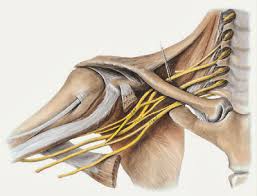 Chấn thương đám rối thần kinh cánh tay - Ảnh minh họa 3