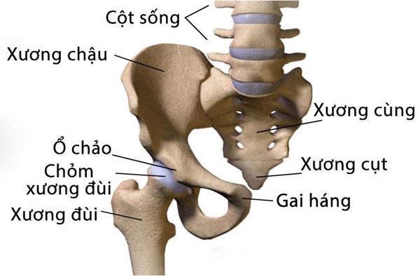 Chứng trượt đầu trên xương đùi (SCFE) - Ảnh minh họa 4