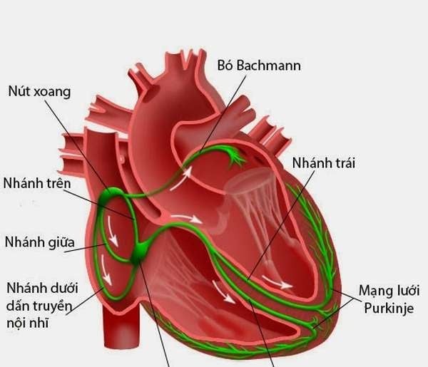 Infective endocarditis - Ảnh minh họa 2