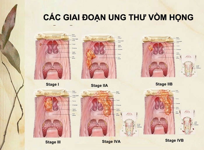 K vòm - Ảnh minh họa 3