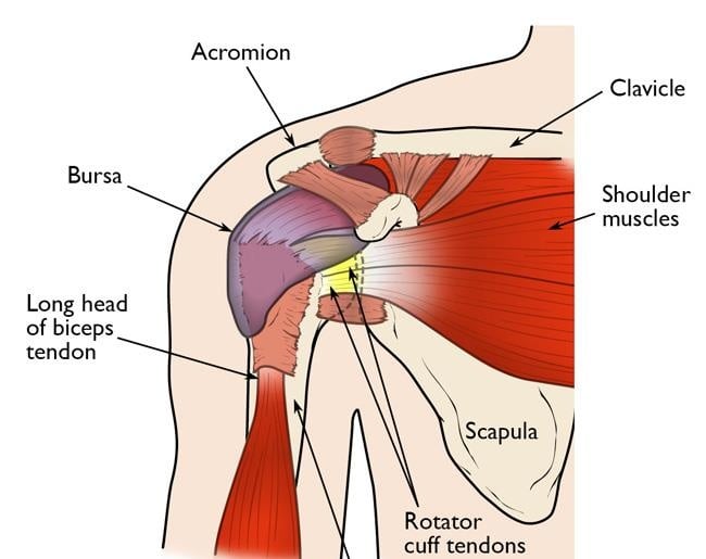 Hội chứng Rotator cuff - Ảnh minh họa 1