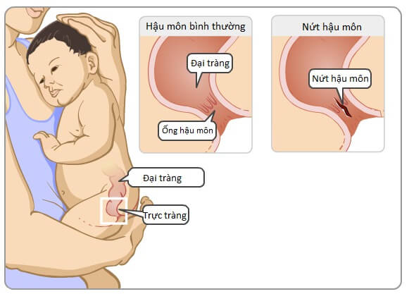 4. Phương pháp điều trị và can thiệp y tế