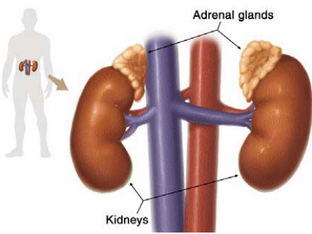 U tủy thượng thận - Ảnh minh họa 1