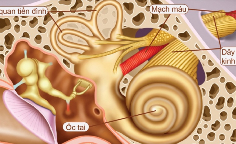 U dây thần kinh thính giác - Ảnh minh họa 4