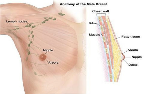 Ung thư vú ở nam giới - Ảnh minh họa 3