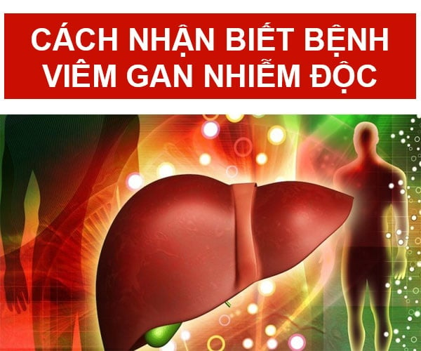 Viêm gan do nhiễm độc - Ảnh minh họa 5