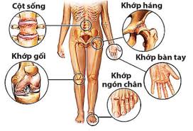 Viêm khớp nhiễm khuẩn - Ảnh minh họa 4