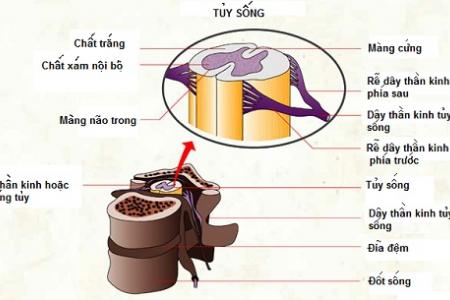 Viêm tủy cắt ngang - Ảnh minh họa 2