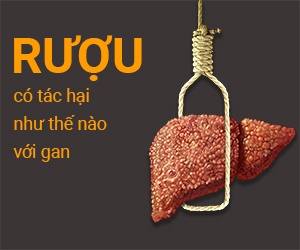 Viêm gan do rượu - Ảnh minh họa 2