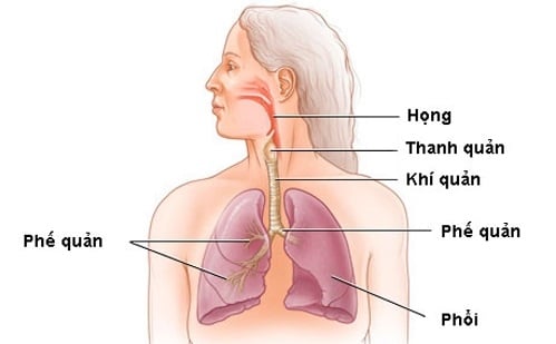 Viêm thanh quản hầu - Ảnh minh họa 5