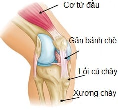 Viêm gân xương bánh chè - Ảnh minh họa 4